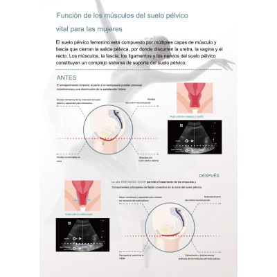EMSELLA - Silla suelo pelvico