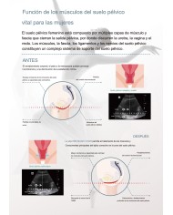 EMSELLA - Silla suelo pelvico